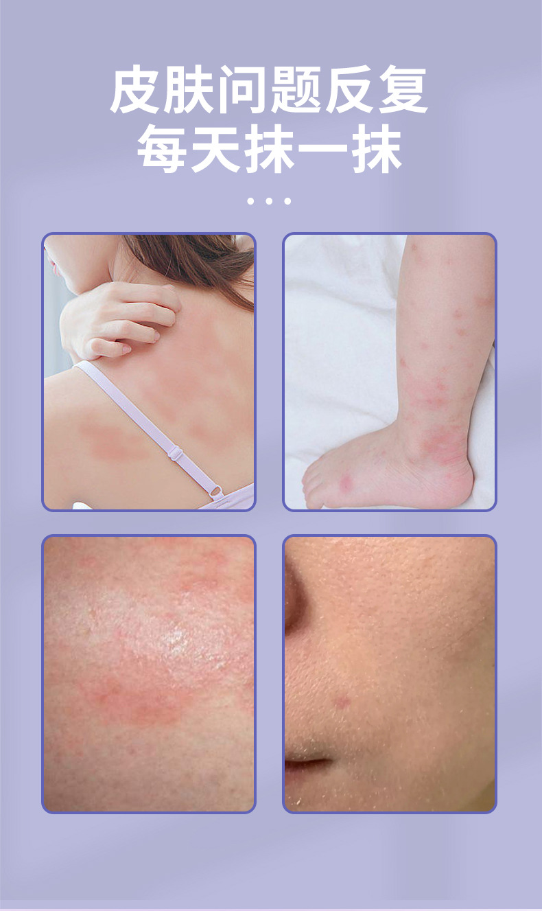 南瑶之秘紫花地丁抑菌膏30g皮肤止痒外用草本涂抹乳膏紫花地丁膏详情4