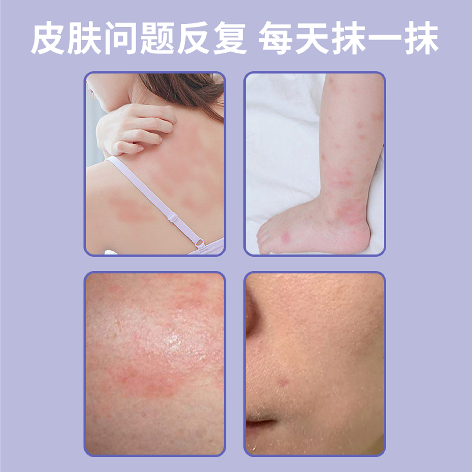 南瑶之秘紫花地丁抑菌膏30g皮肤止痒外用草本涂抹乳膏紫花地丁膏详情图3