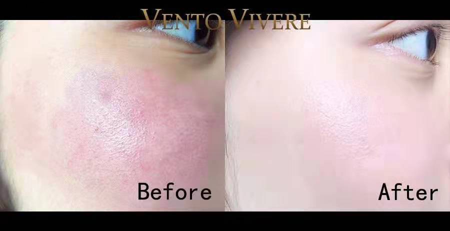 瑞士 vento vivere维美瑞 白松露焕颜面霜详情6